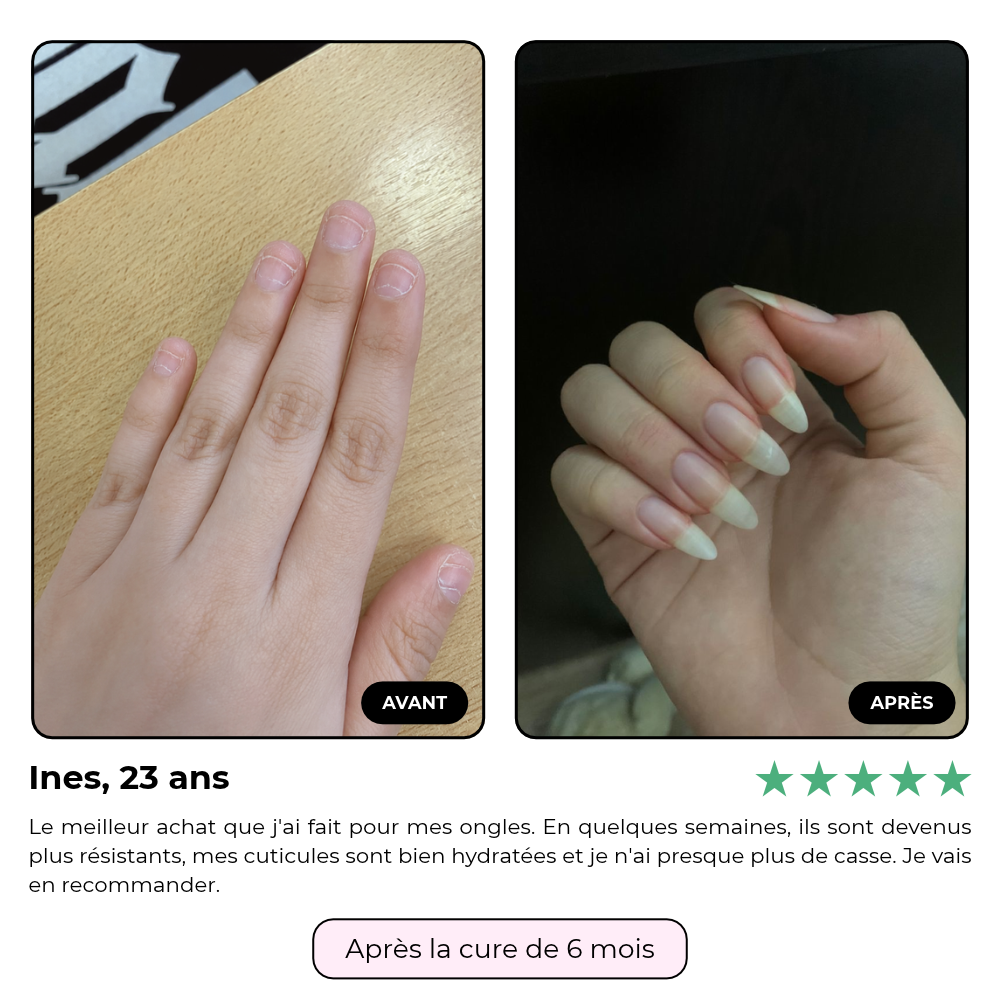 L'huile pousse anti-casse - Novanails