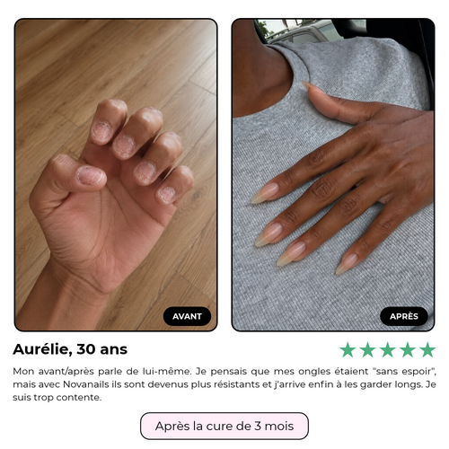L'huile pousse anti-casse - Novanails